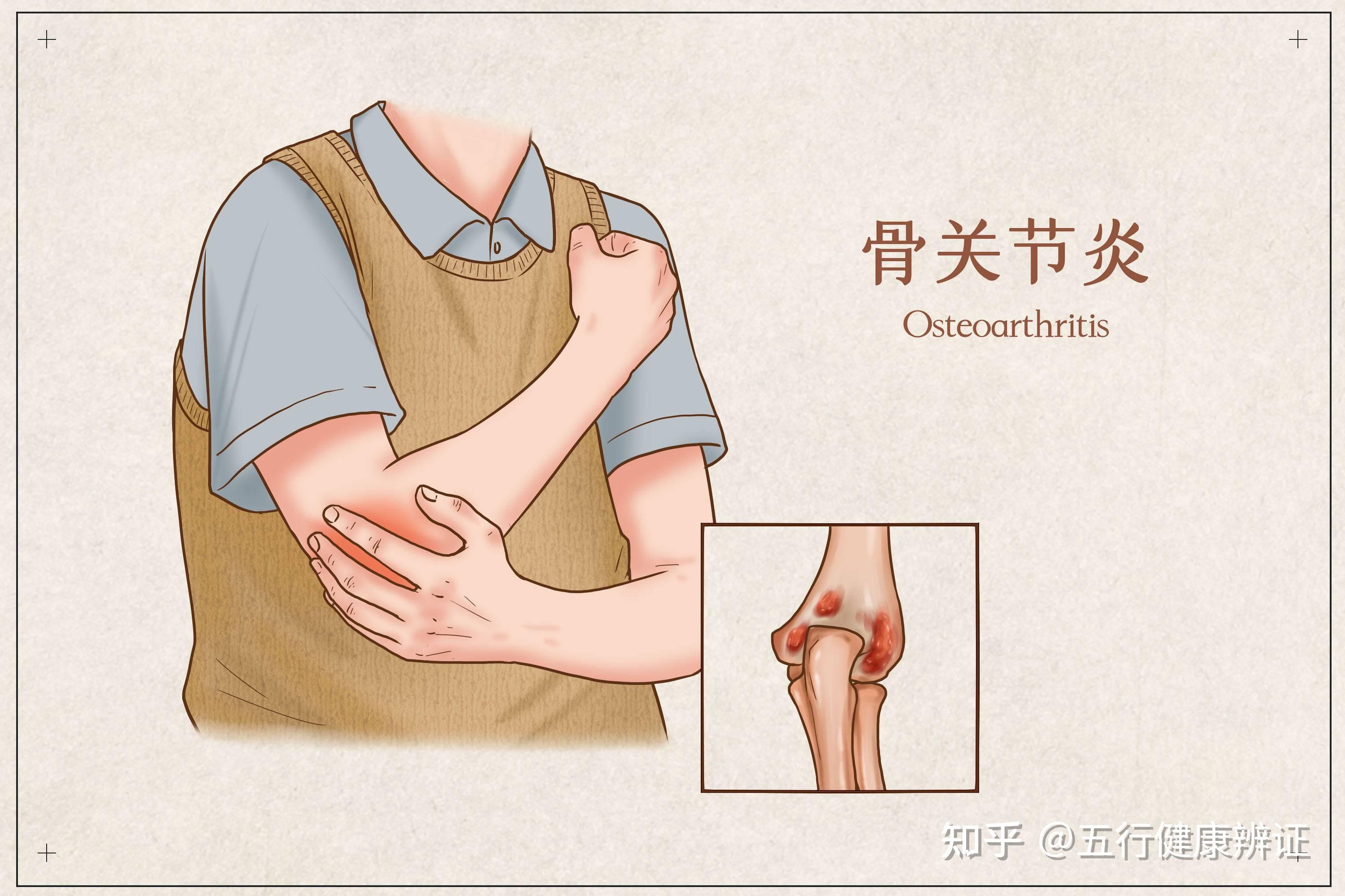养生宝典：从绝骨穴【悬钟穴】看胆和骨之间的紧密联系 - 知乎