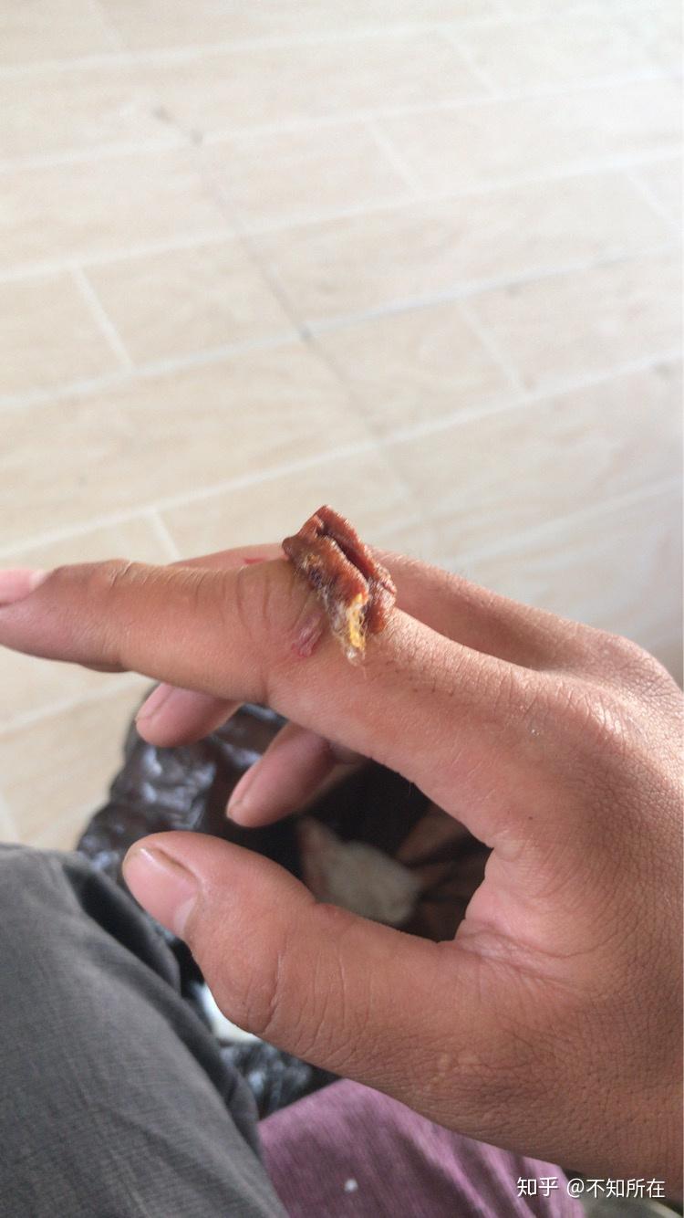 被老鼠咬了怎么办? - 知乎