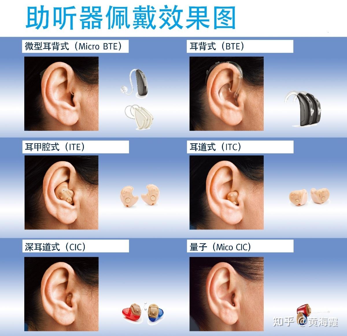 戴助听器或人工耳蜗效果评估有哪些思路？ - 知乎