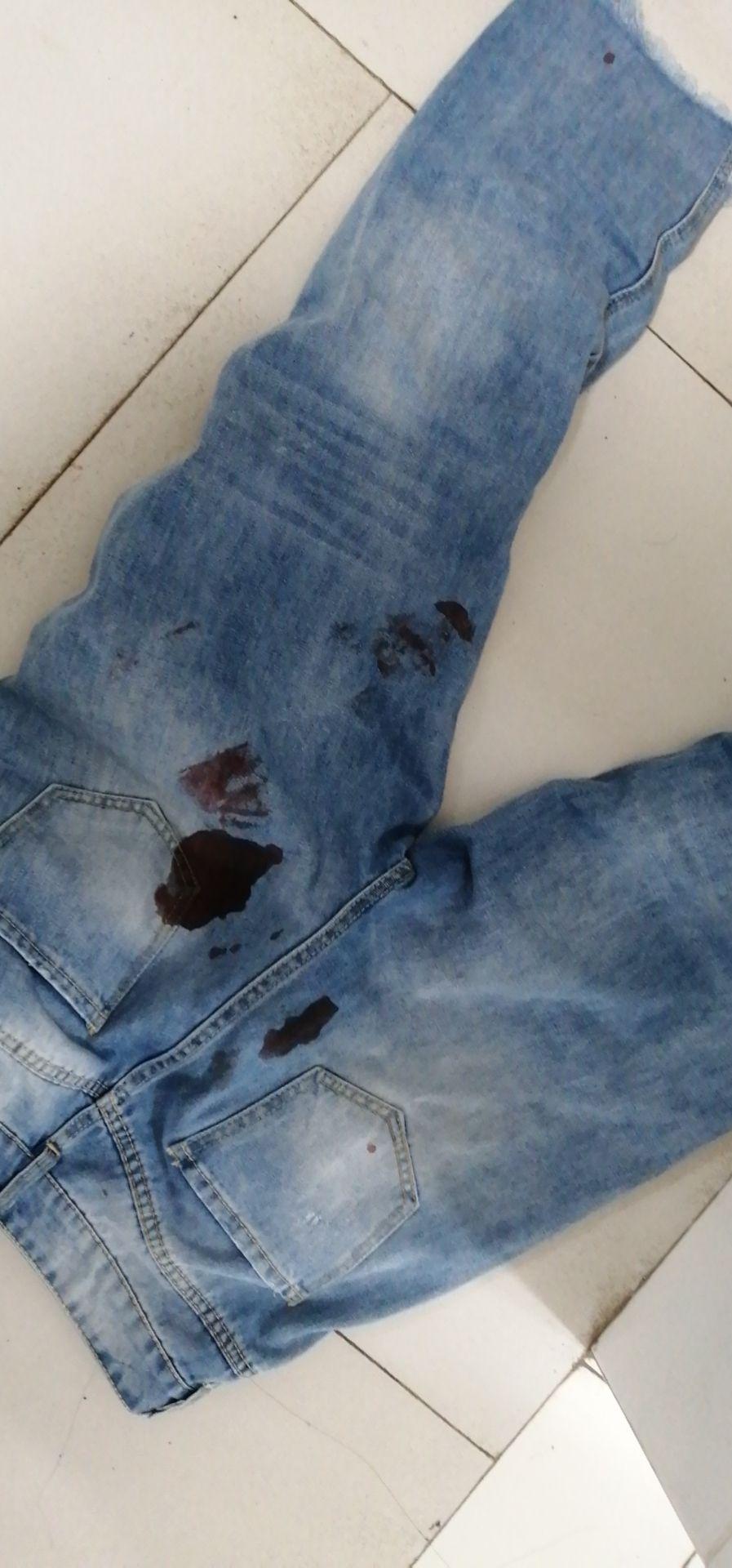 女生有哪些印象深刻的月经血崩经历? - 知乎