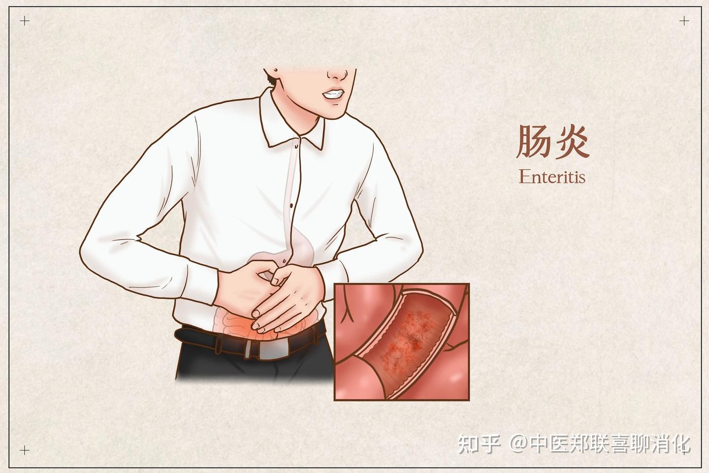 泄泻病是什么?以及它的危害 - 知乎