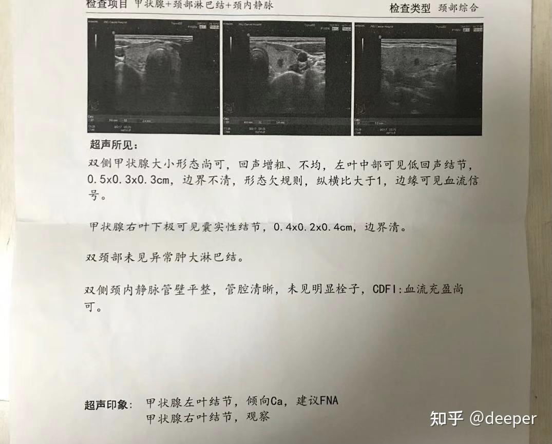 一張圖看懂甲狀腺彩超結果