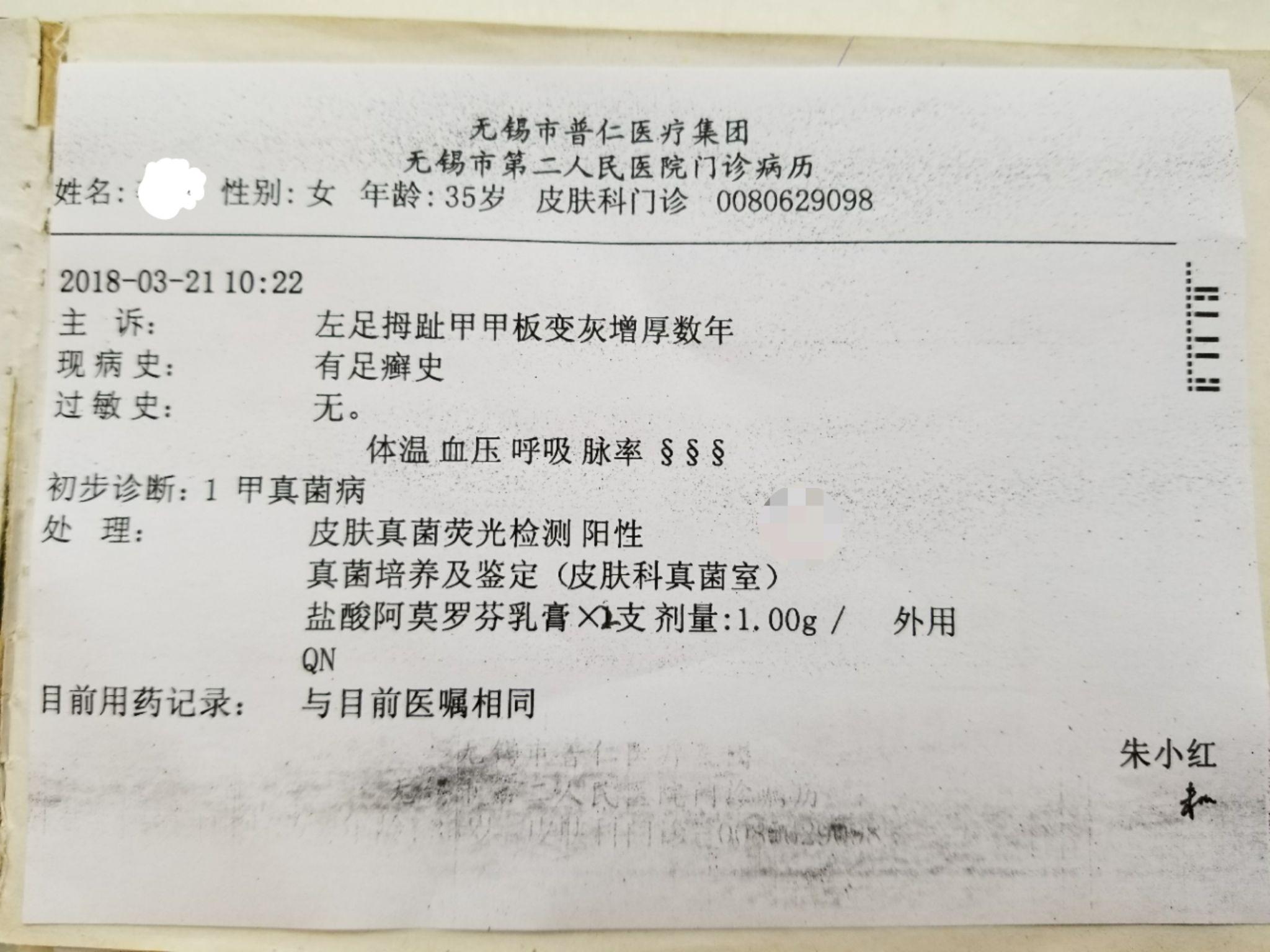 大夫一看说去做个真菌化验(180元),毫无悬念,菌丝阳性,给开了两支盐酸