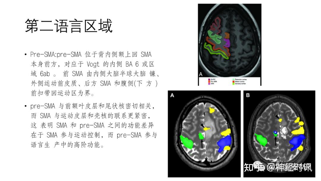 脑功能成像解剖 — 知识分享 - 知乎