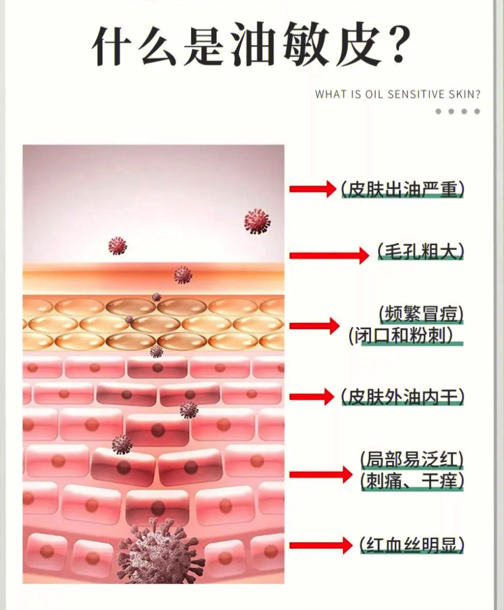 什么是“油敏皮”?油敏皮有哪些表现…… - 知乎