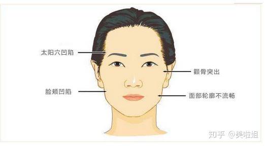 哪些花数10w做磨骨的人怎么样了 是太阳穴凹陷 还是颧骨突出呢 知乎