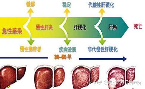 得了 乙肝 就只能坐等肝硬化吗 别急 5分钟让你规避盲区 知乎