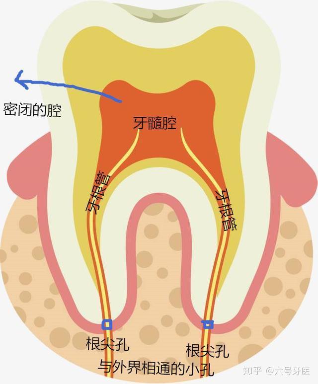 乳牙髓腔图片