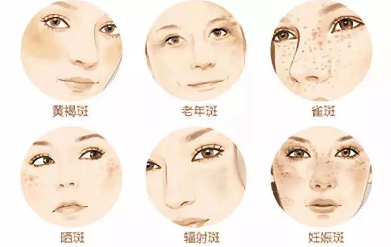 v2-31056a452f6094c18dceb3575b43eb9e_1440w.jpg?source=172ae18b