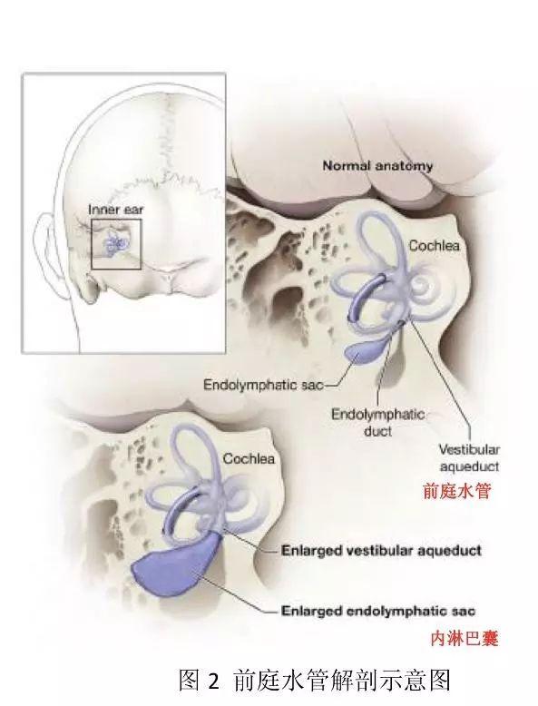 读懂“大前庭导水管”的解剖及生理 - 知乎
