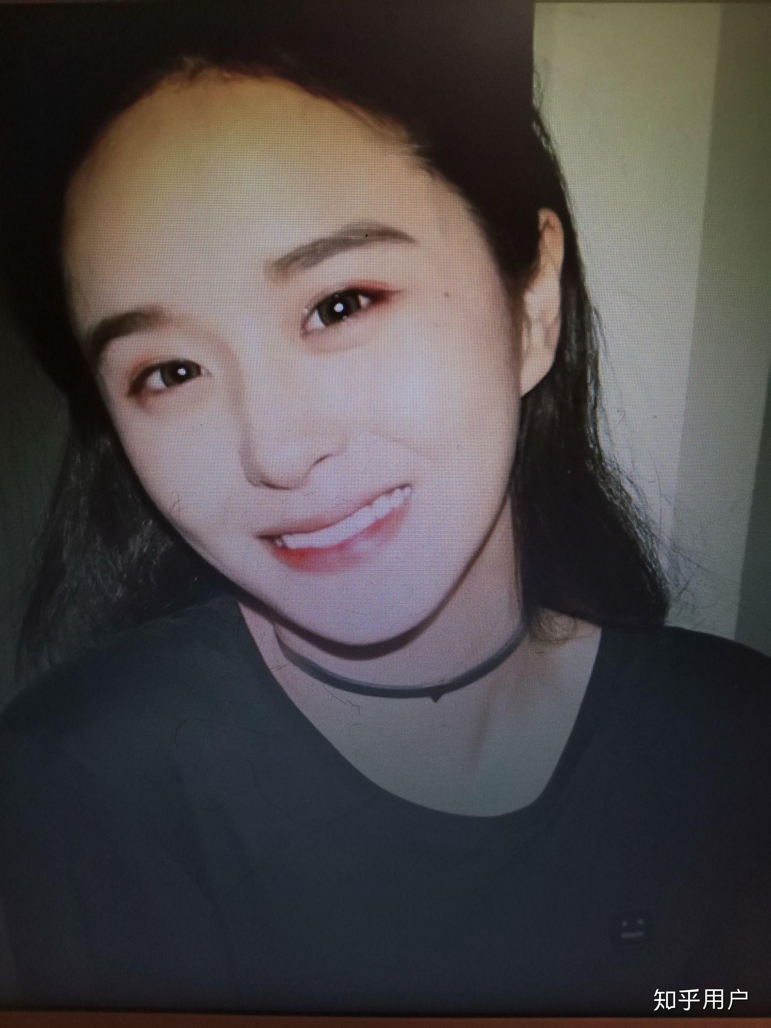 抖音里叫steph的网红动过刀子吗? - 知乎