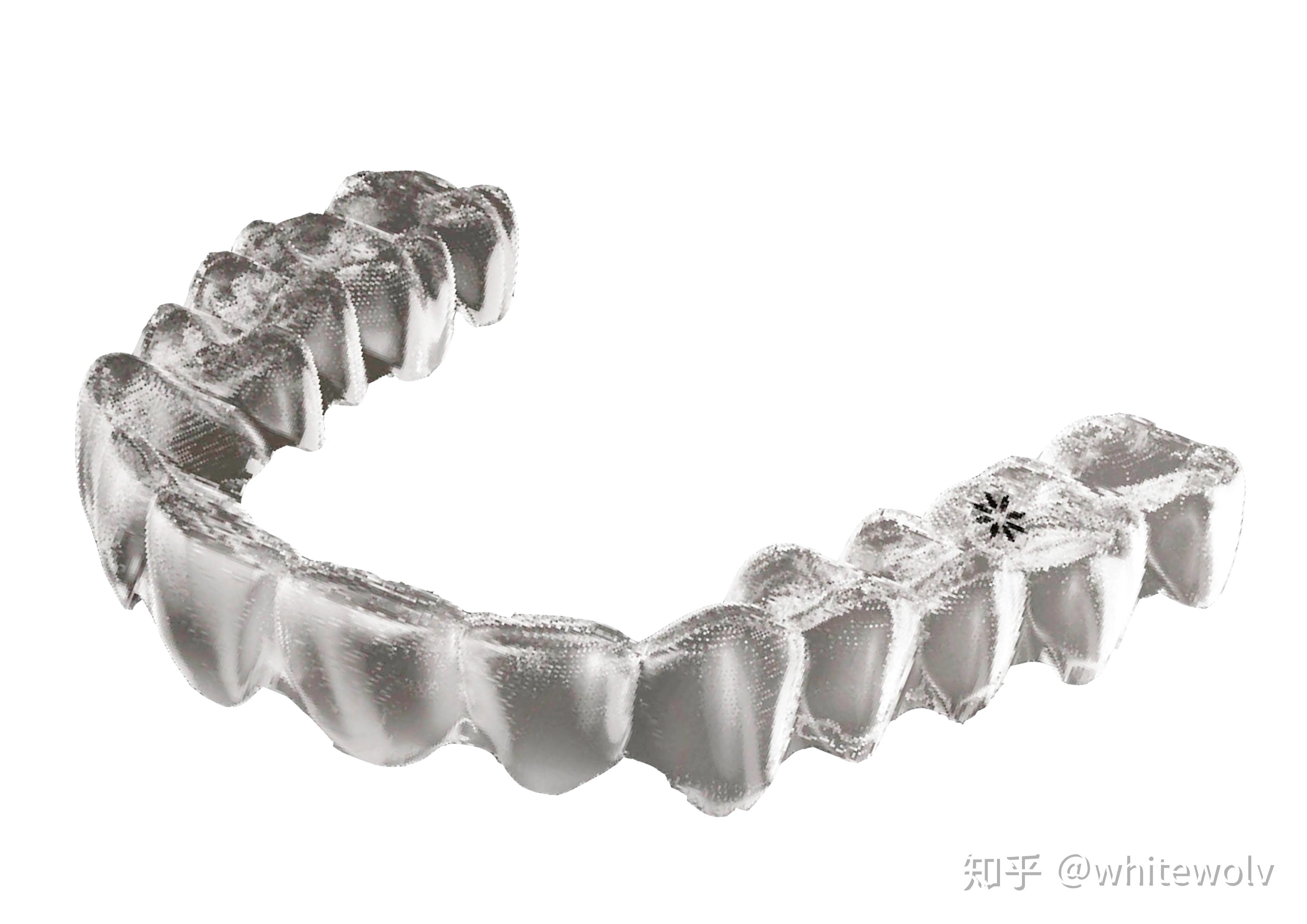 4万rmb的“隐适美隐形牙套”窟牙-正畸全记录（八牙拔除+打骨钉） - 知乎
