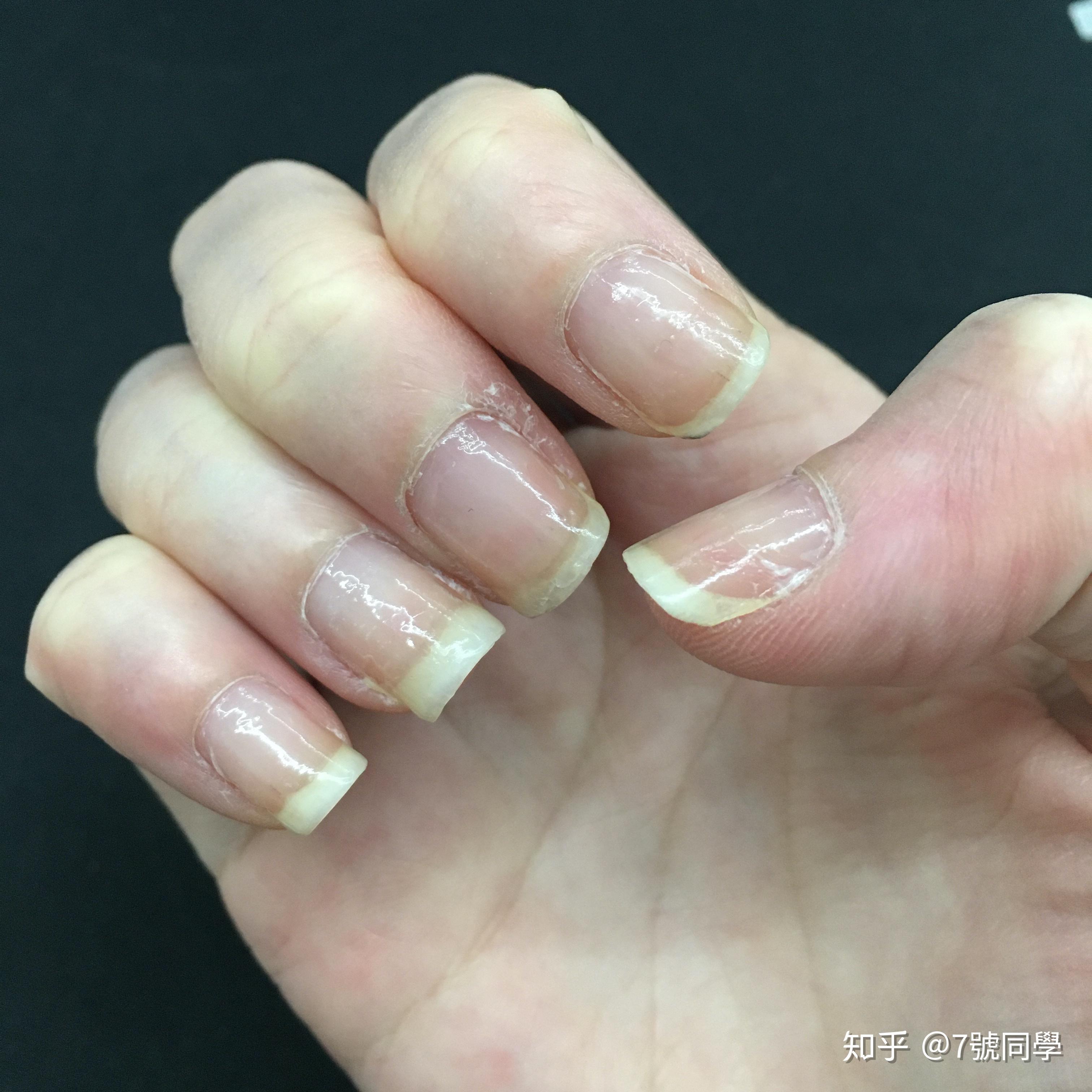留长指甲会使甲床变长吗? - 知乎