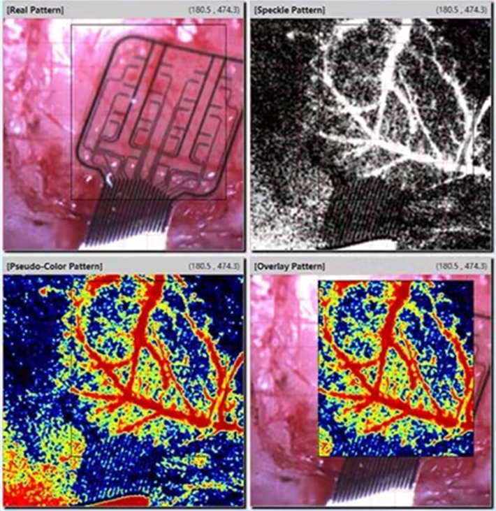 真实案例：散斑用户的使用感受分享 - 知乎