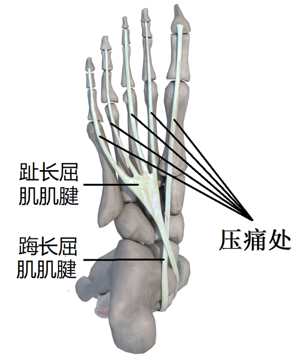 趾长伸肌腱解剖图图片