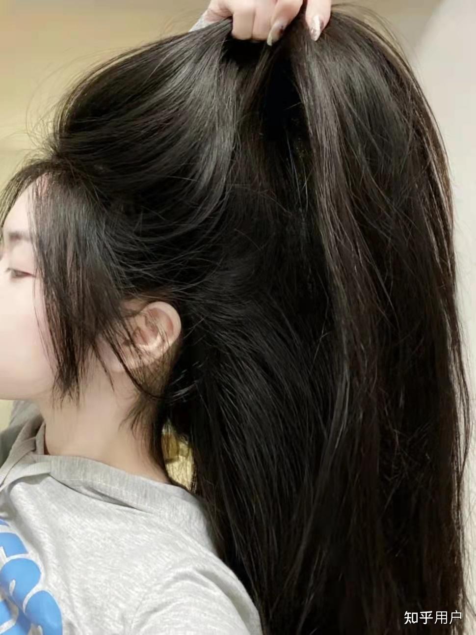 如何长出乌黑浓密的头发? - 知乎