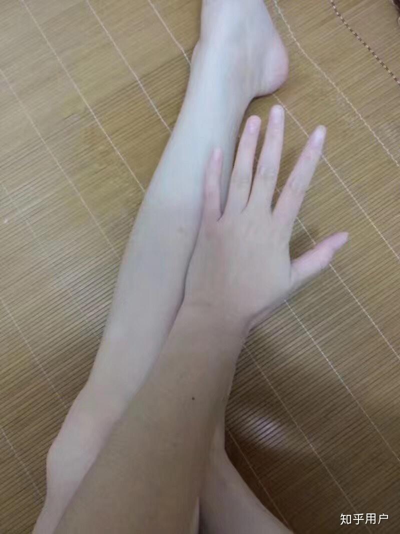 胳膊怎么变白啊