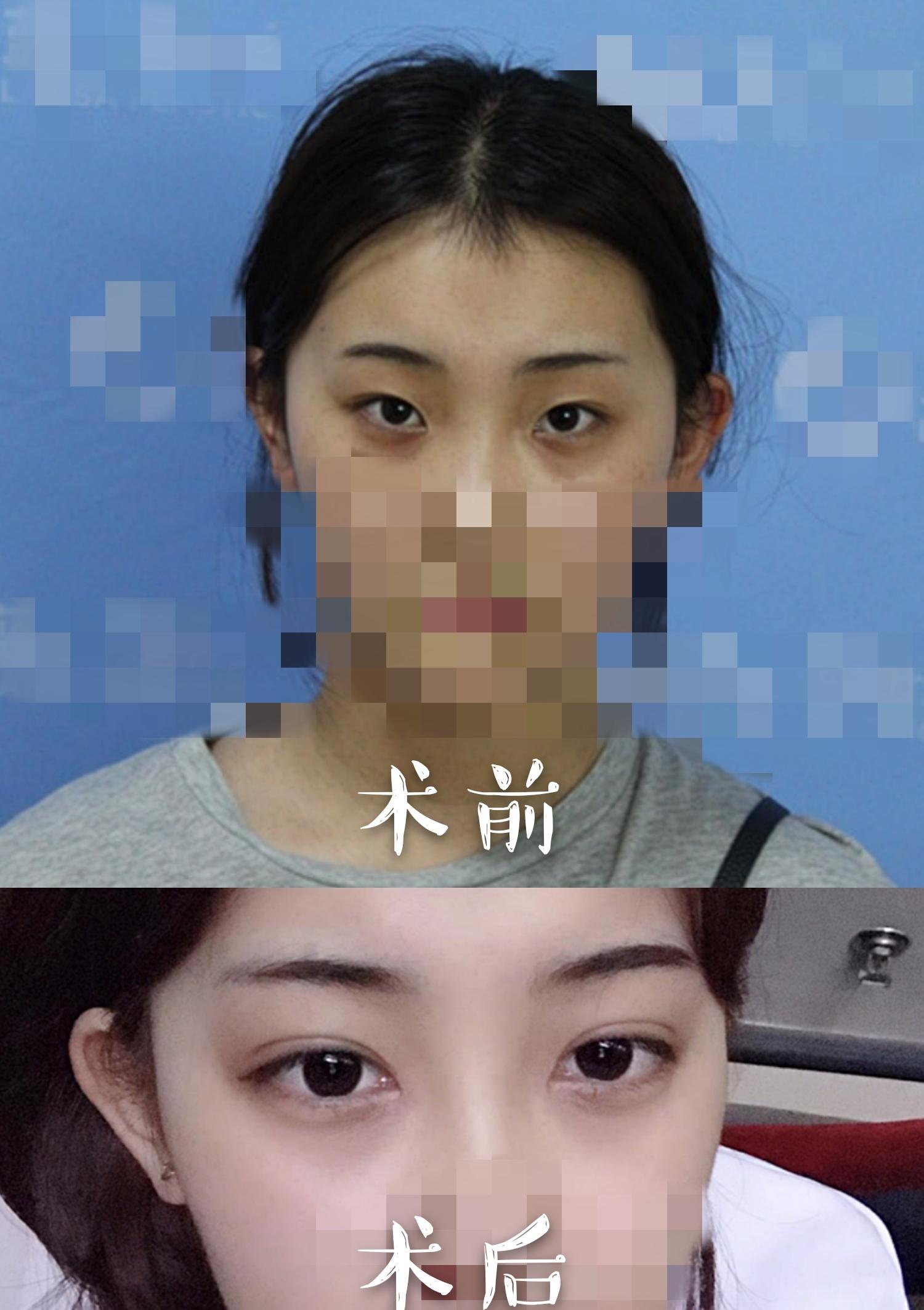 v2-31817b08f3be14cea5037cc5bc5c4a8c_r.jpg