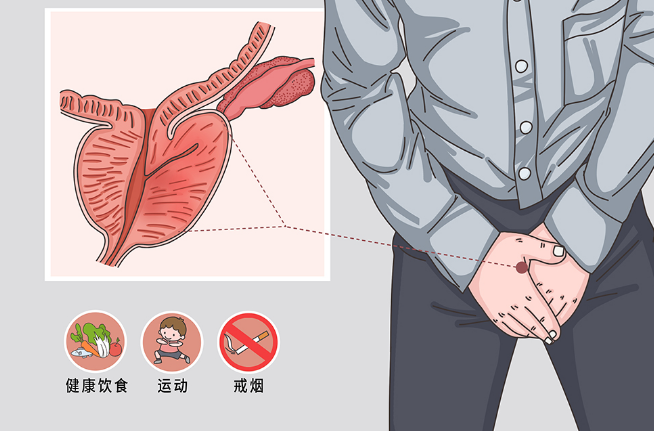 尿頻尿急陰囊潮溼很難受是什麼病