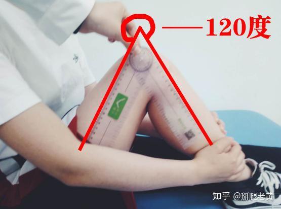 膝关节角度