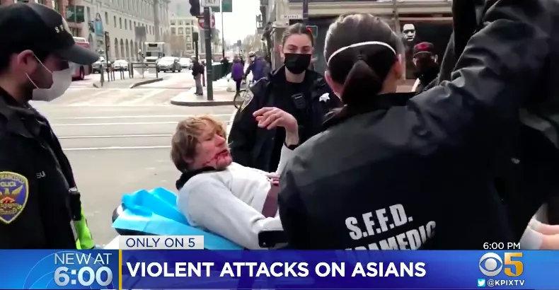 如何看待美国掌掴亚裔挑战