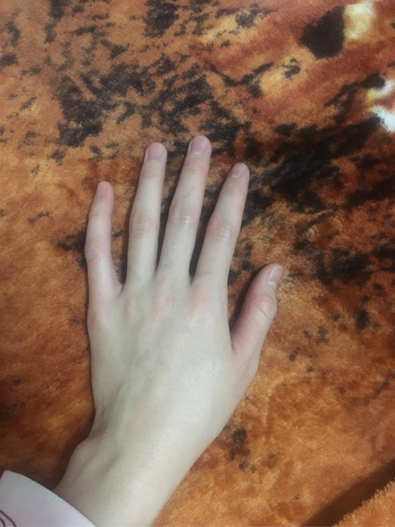 女孩子手长得丑关节大且扭曲之类的像枯枝一样是什么体验