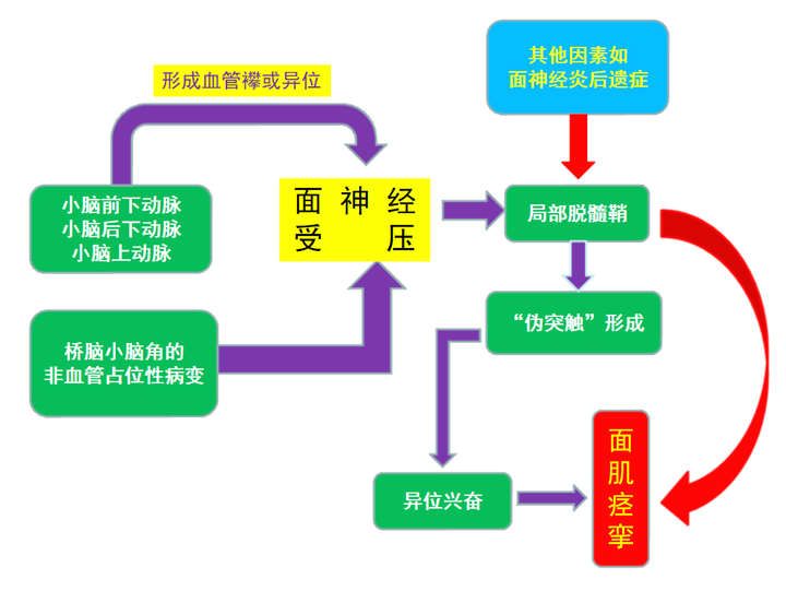 一张图看懂面肌痉挛脸抽搐形成的全过程 - 知乎