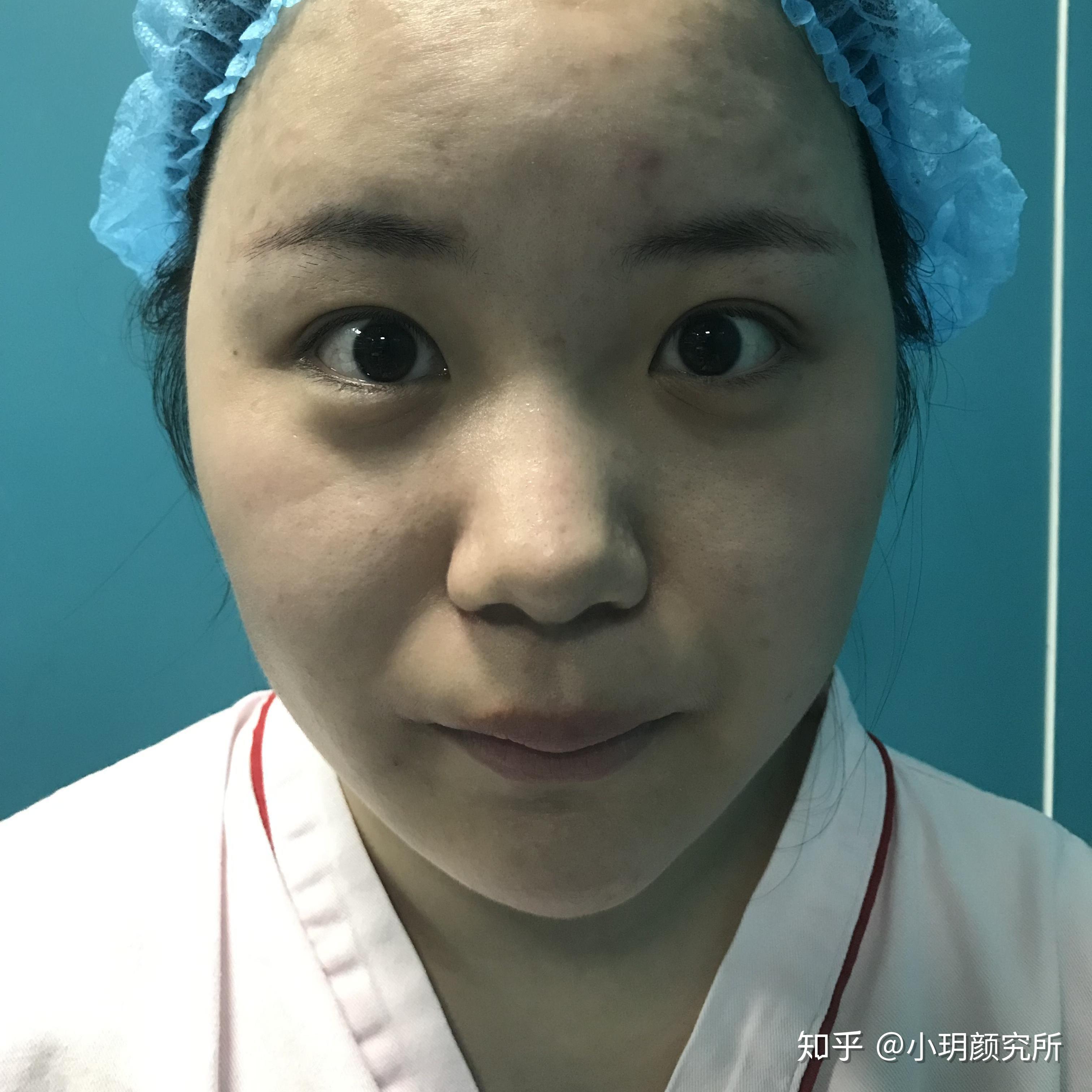 上海双眼皮眼王是谁