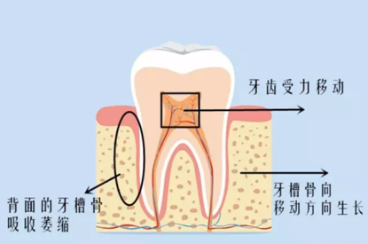 牙齿缝隙变大的原因 v2-32458f7a1046f1b678f758a2c9f63424_b.jpg