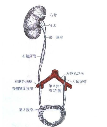 有什么方法可以快速排出尿道结石 v2-325121b2d869bca0c07f6df2f29ce9cc_r.jpg