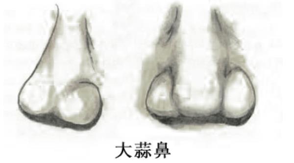 了解一下常见的鼻型都有哪些? - 知乎