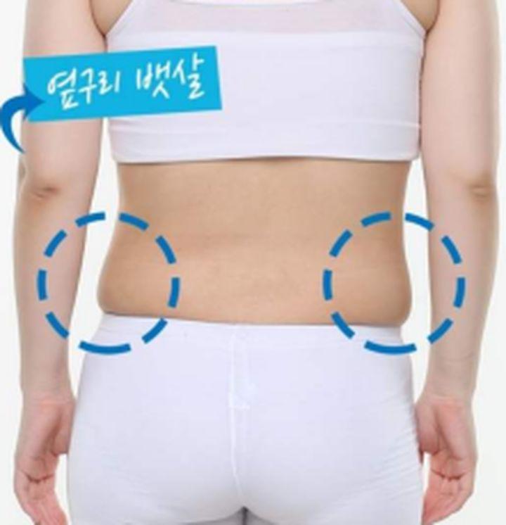 这种大多见于产后女性,由于生产后肚皮的肌肉变得松弛,失去弹性,容易