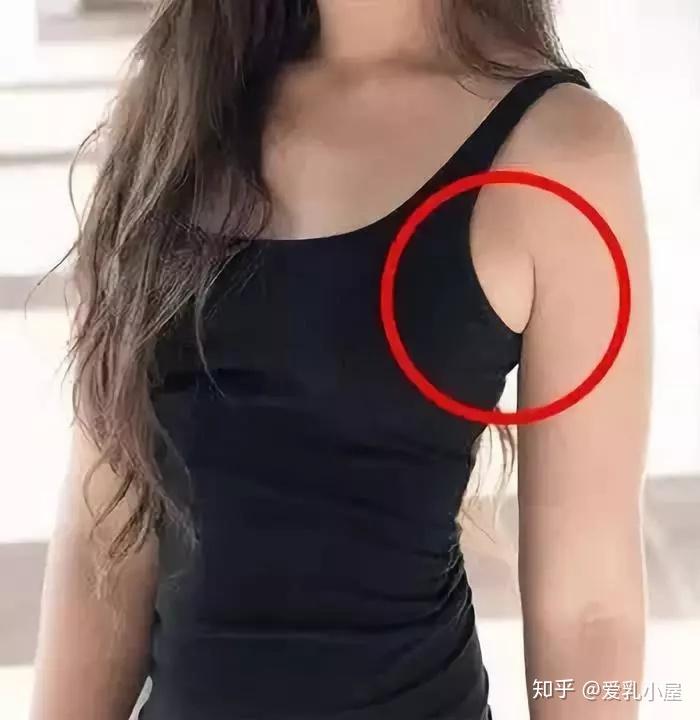 医生我腋下多块肉大夏天的穿吊带想露却不敢露怎么办