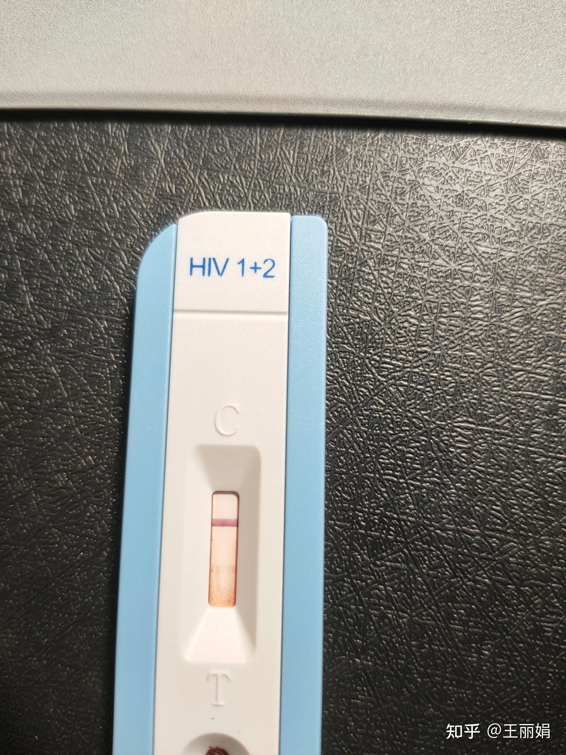 hiv检测试纸阳性,一定感染了hiv吗?