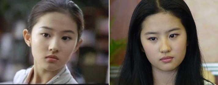 网红们开始给耳朵做整形了 精灵耳开始风靡 知乎