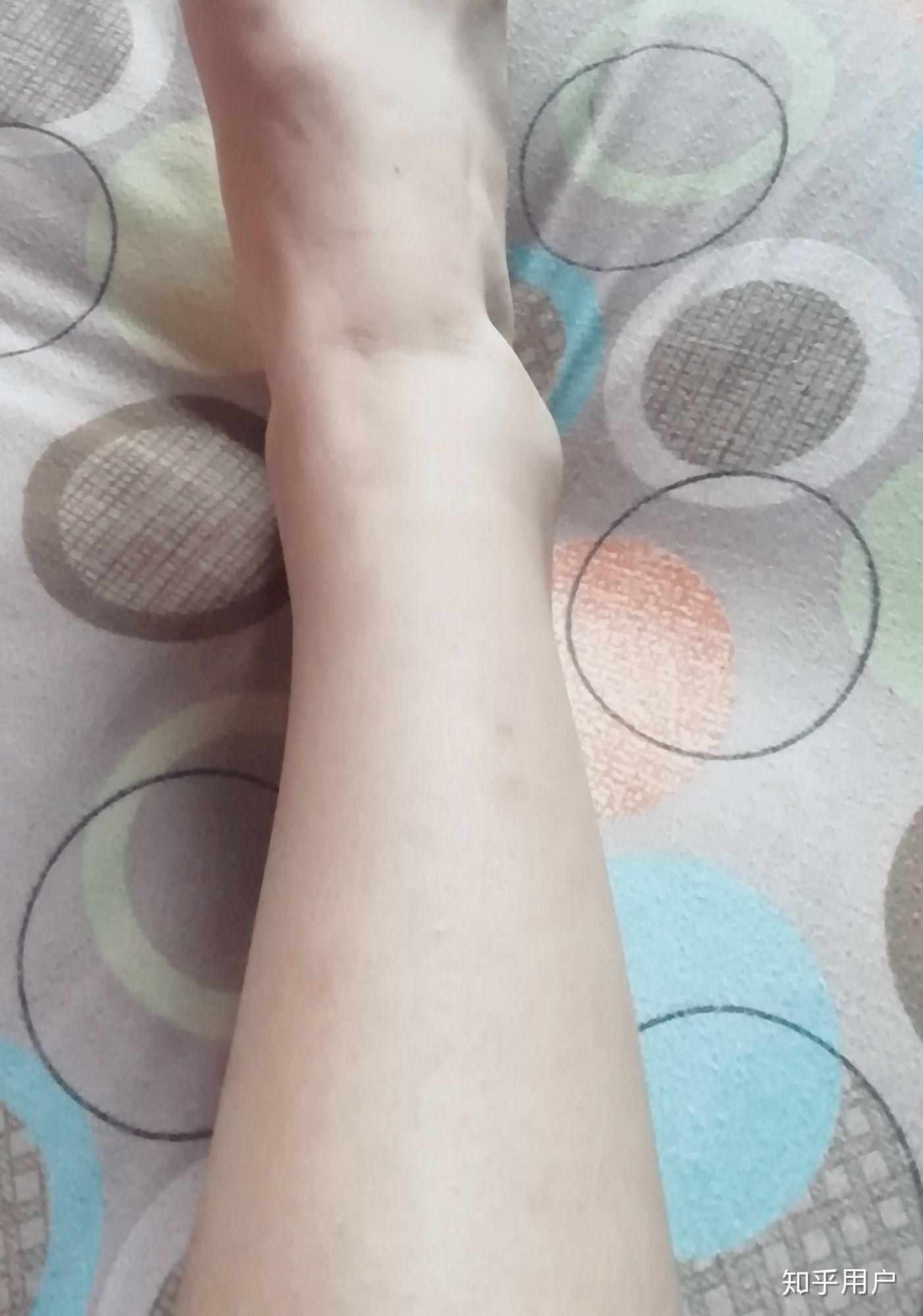 如何判断脚踝好不好看