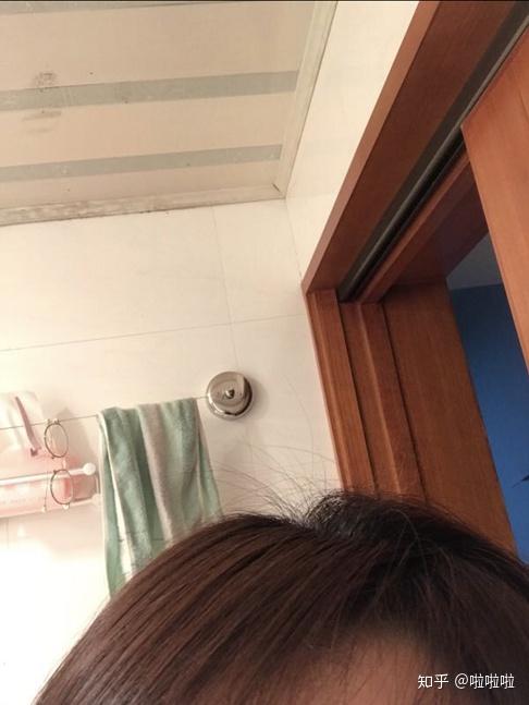 如何减肥不掉头发还有效 v2-32d9e5ca6dfdd0a5d504a2ee63737b70_r.jpg