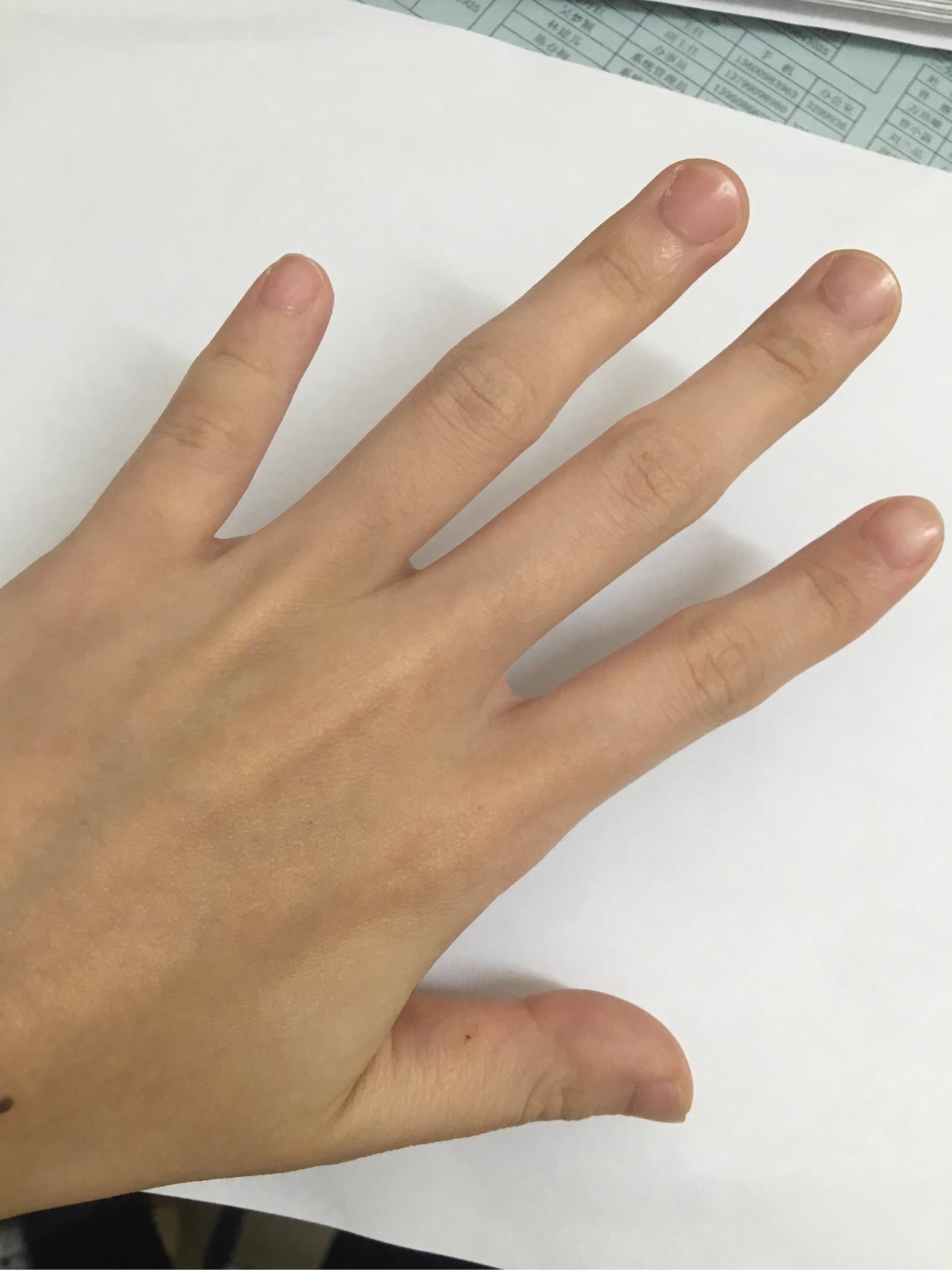 小拇指很短的人能弹钢琴吗? - 知乎