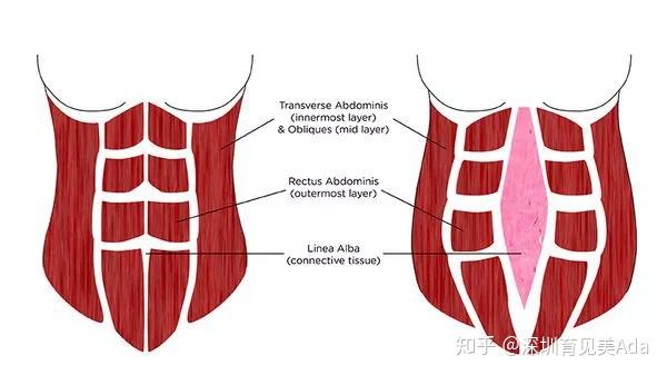 悬垂腹之产后恢复运动