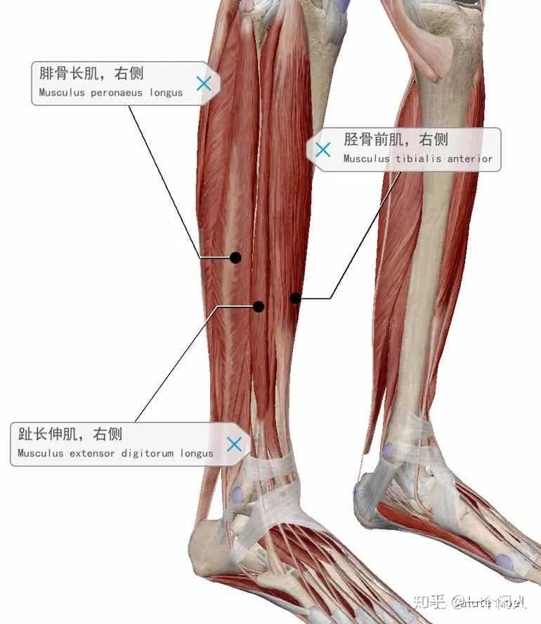 请问这个是肌肉型小腿嘛要怎么瘦呢