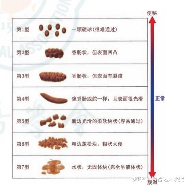 引起慢性腹泻的因素有哪些？ 知乎 8725