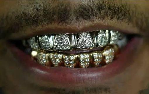 口腔科普铁齿铜牙vs唇红齿白如何选择牙冠修复材料一篇文章教你全方位