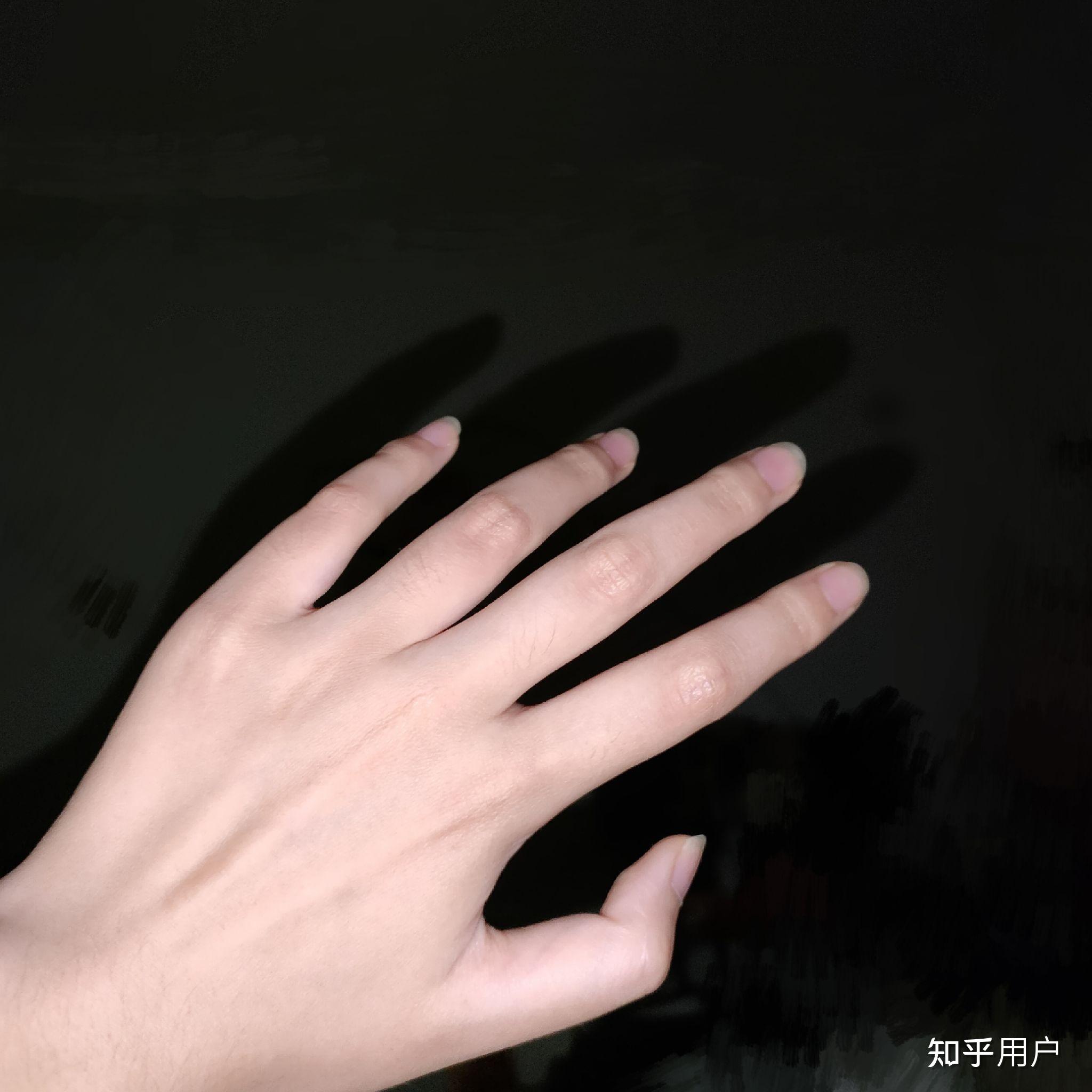 我是女生,手背上汗毛很多,毛孔特别大,密密麻麻的,大家有紧毛孔的办法