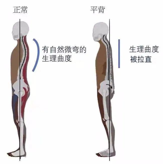 抬头挺胸收腹走路图图片