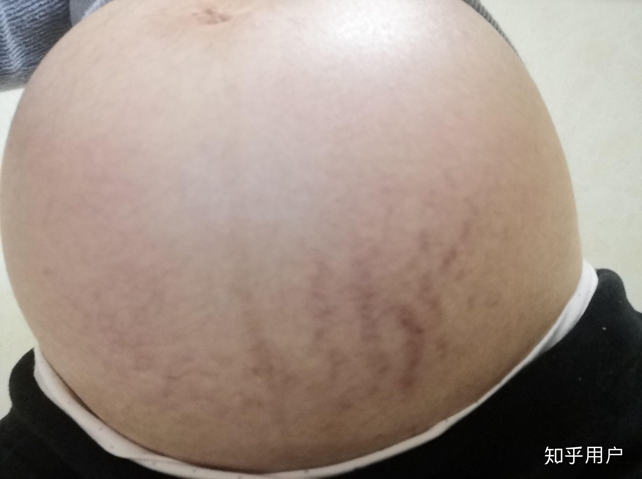 29周早产儿全身插满管子，哭起来胳膊都在颤抖，看着好心疼 - 早产 - 蓝灵育儿网