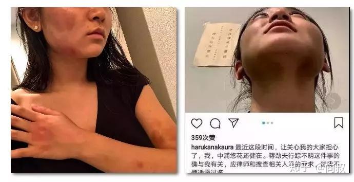 蒋劲夫家暴能打女人的男人不配被原谅