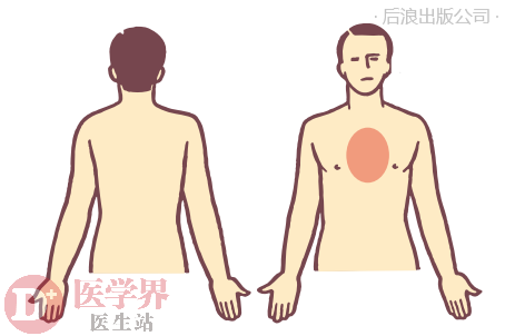 蜜橙好医 胸痛的性质 部位怎么看 这篇文章说全了 知乎