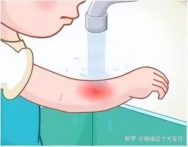 被猫“抓伤”怎么办?这些处理,缺一不可 - 知乎