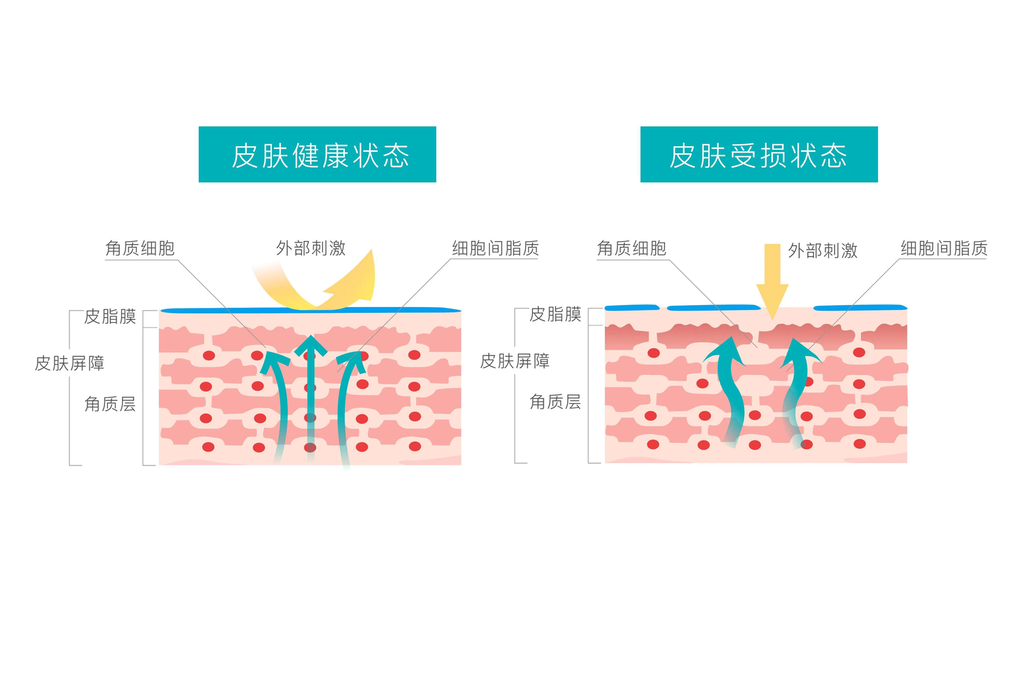 敏感肌怎么来的？这种肤质要怎么护肤？