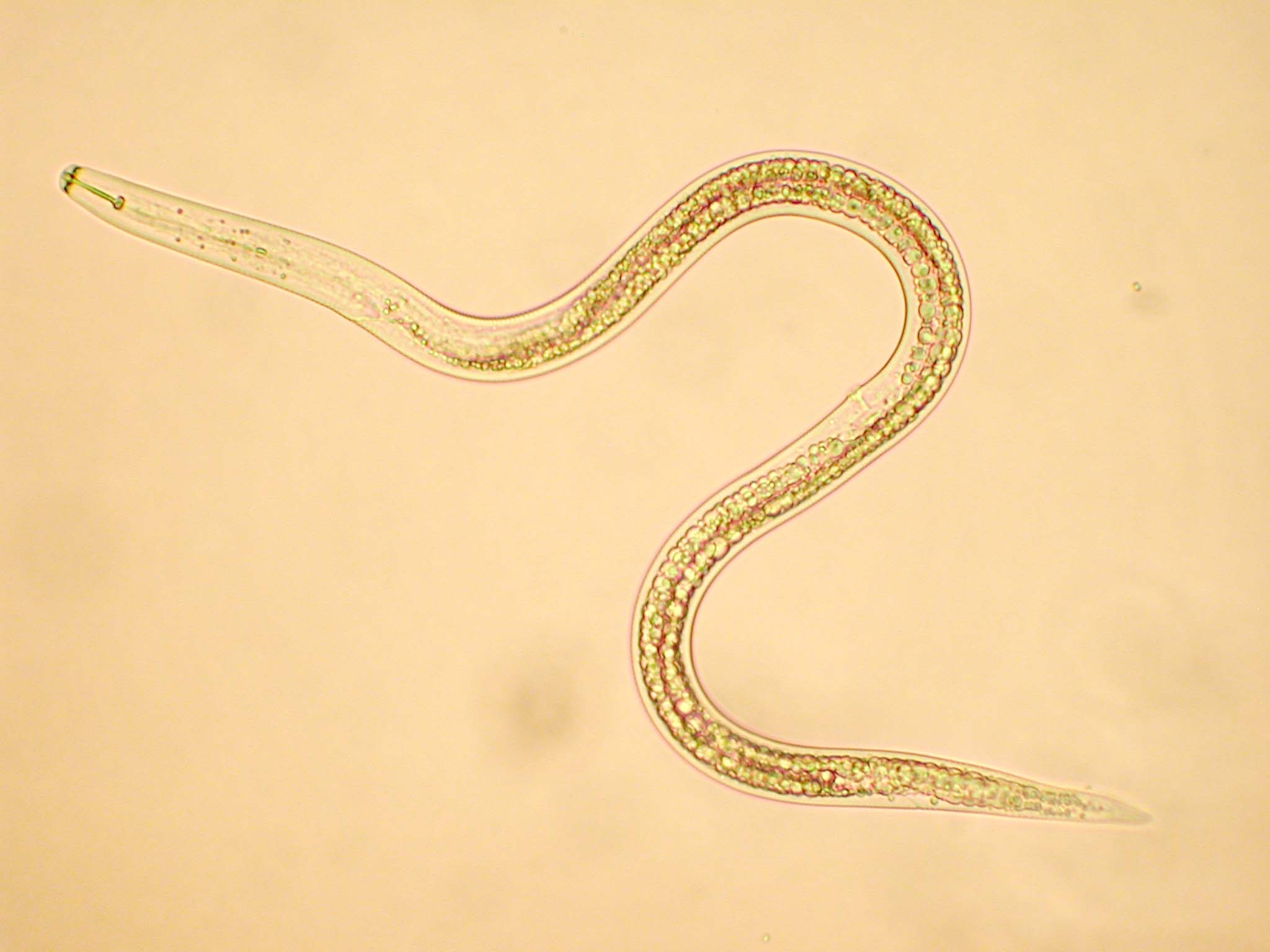 铁线虫显微镜下的图片图片